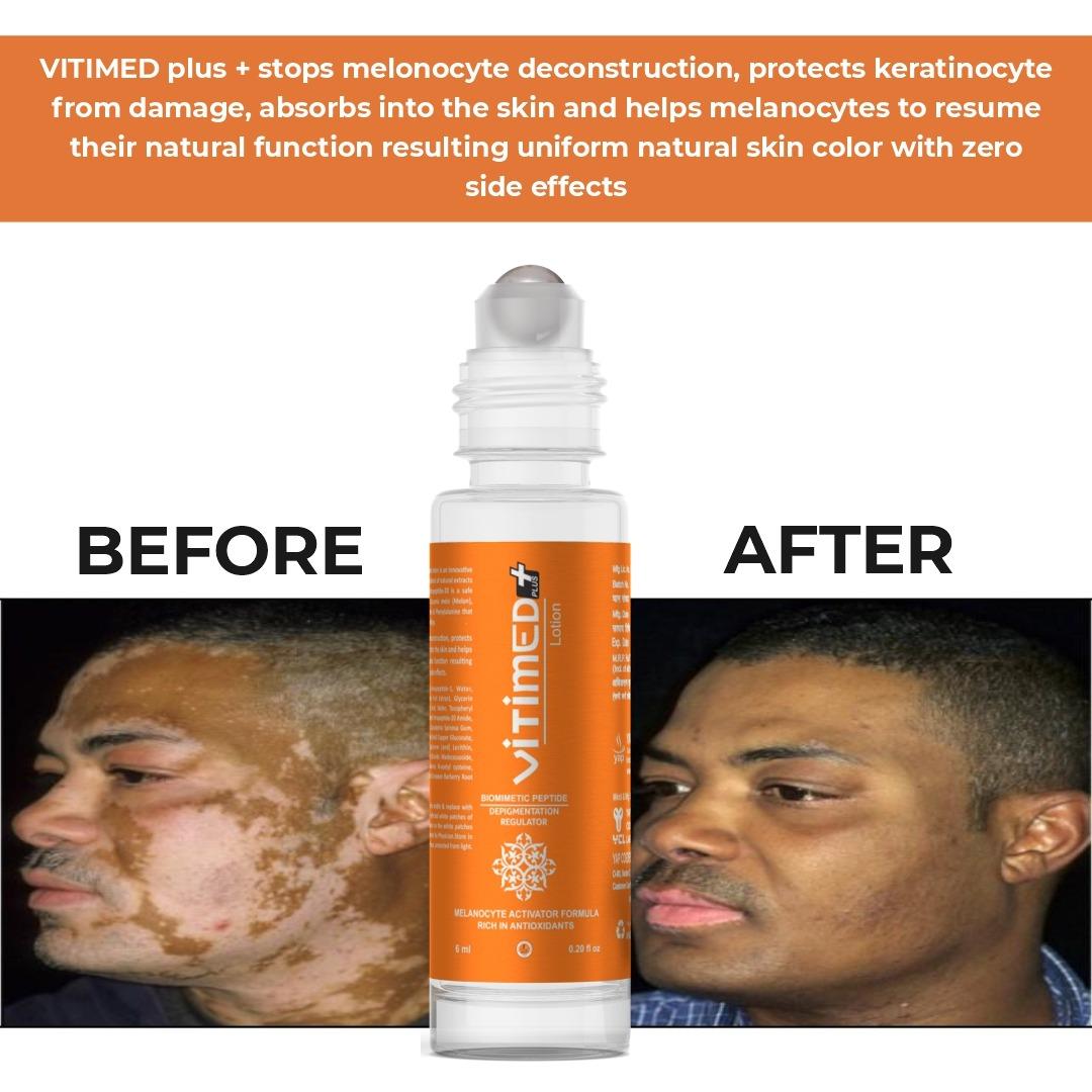 Vitimed Plus Lotion - Image 7